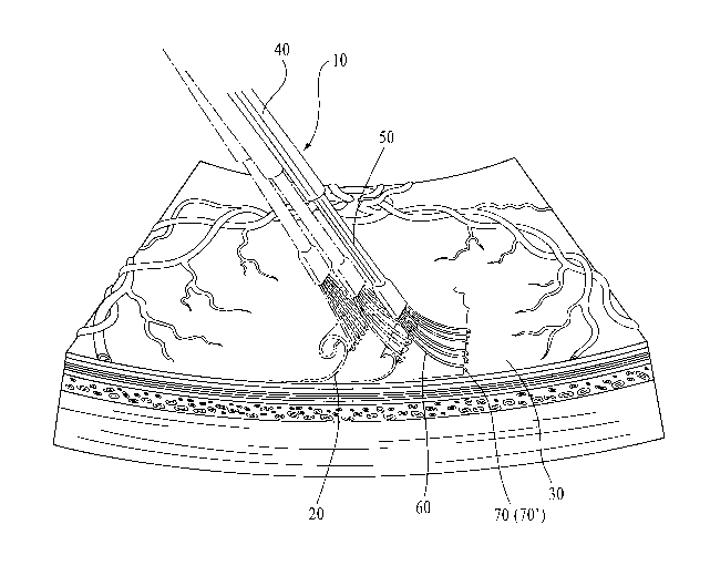 A single figure which represents the drawing illustrating the invention.